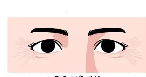 4 duong net hung du thuong thay tren khuon mat