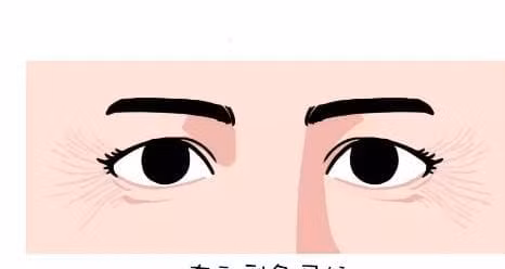 4 duong net hung du thuong thay tren khuon mat