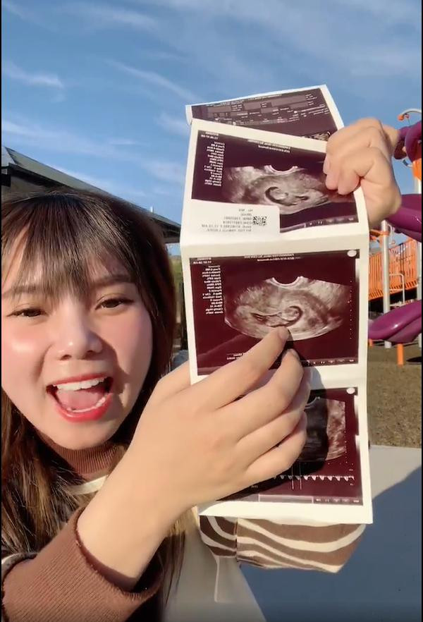 Cap dong tinh nu Bi Bao - Mui Xu buon ba chia xa-Hinh-4