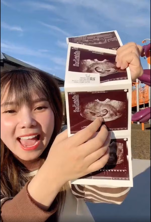 Cap dong tinh nu Bi Bao - Mui Xu buon ba chia xa-Hinh-4