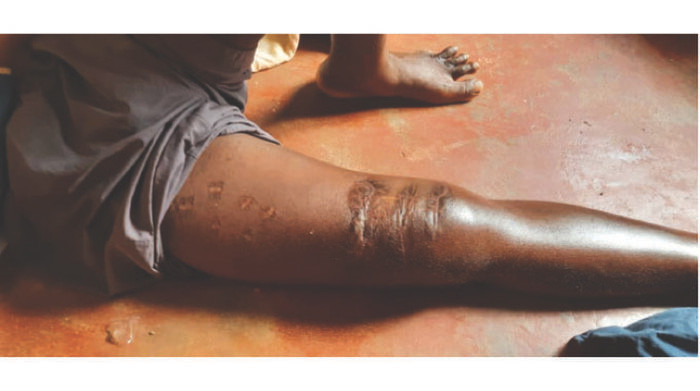 Người đàn ông sống sót sau khi bị 3 con cá sấu "xâu xé" - Hình 3 Nguoi dan ong song sot sau khi bi 3 con ca sau