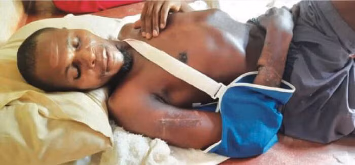 Nguoi dan ong song sot sau khi bi 3 con ca sau 