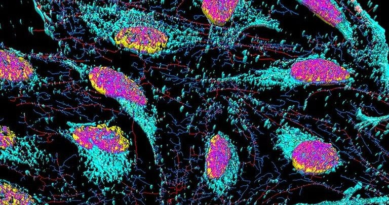 Tuổi thọ của loài người có thể đạt tới 1.000 - Hình 3 Tuoi tho cua loai nguoi co the dat toi 1.000-Hinh-3