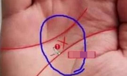 Hinh chu thap trong duong chi tay duoc vi nhu “mat troi” hiem thay-Hinh-4