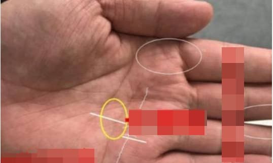 Hinh chu thap trong duong chi tay duoc vi nhu “mat troi” hiem thay-Hinh-3