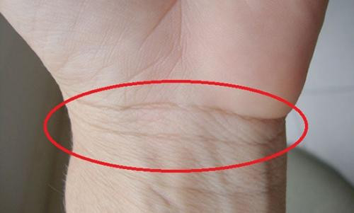 Nhìn 3 giây vào đường ngấn cổ tay sống thọ hay yểu mệnh - Hình 2 Nhin 3 giay vao duong ngan co tay song tho hay yeu menh-Hinh-2