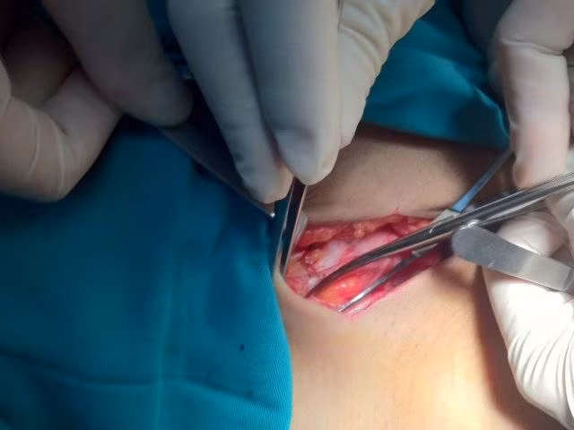 Can benh pho bien o be trai, nguy co anh huong sinh ly