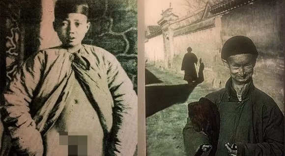 Ly do thai giam co dai quan khan quanh eo ca doi-Hinh-2