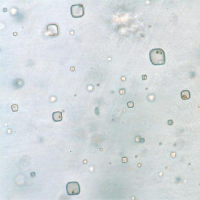 Phát hiện "xác ướp" sinh vật cổ đại 830 triệu năm tuổi kẹt trong đá Phat hien