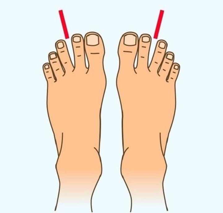  Khoảng cách lớn giữa ngón thứ hai và thứ ba. Chủ nhân của kiểu bàn chân này là người có thể tách bạch cảm xúc với lý trí. Nếu có kiểu bàn chân như vậy, bạn có thể cân nhắc trở thành một nhà ngoại giao, nhà phân tích hoặc thương nhân. * Thông tin trên chỉ mang tính chiêm nghiệm, tham khảo.