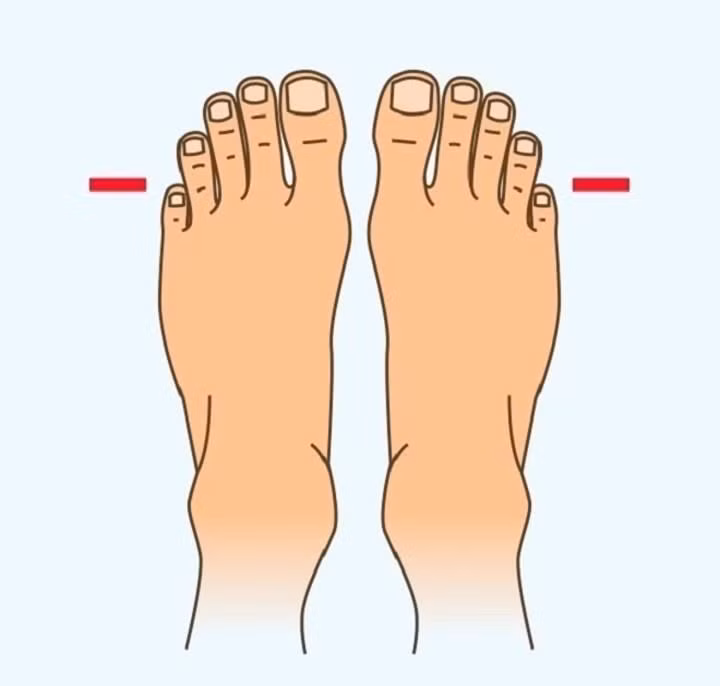  Ngón út rất bé. Chủ nhân của kiểu bàn chân này là những người rất cá tính. Họ thích làm mọi việc theo ý mình mà không cần quan tâm người khác nghĩ sao.