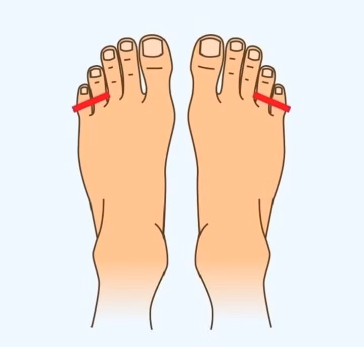  Ngón út không thể tách ra. Nếu bạn chỉ có thể tách ngón chân út của mình bằng tay, bạn thường có cuộc sống trầm lặng, không so đo và dễ đoán. Bạn thường tham công tiếc việc, thích làm việc theo thói quen và nề nếp của mình.