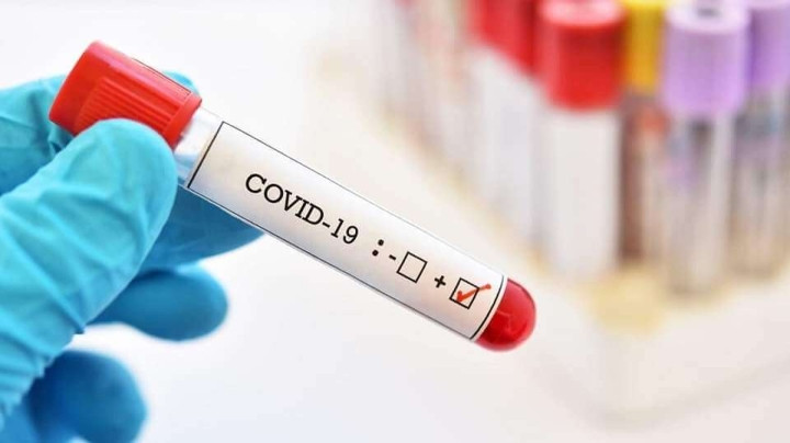 Vừa test COVID 2 vạch, mẹ chồng đã "đuổi khéo" về nhà ngoại Vua test COVID 2 vach, me chong da