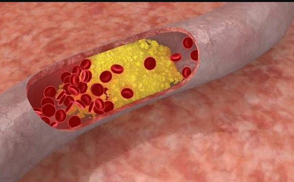 Nam hay nữ, 2 bộ phận này càng "mềm" tuổi thọ càng cao ảnh 1 Nam hay nữ, 2 bộ phận này càng "mềm" tuổi thọ càng cao ảnh 1
