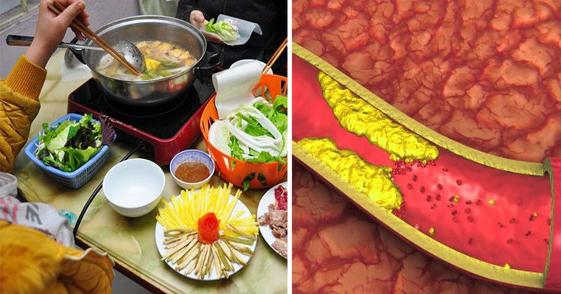 3 loại thực phẩm ăn nhiều khiến mỡ máu tăng không giảm 3 loai thuc pham an nhieu khien mo mau tang khong giam
