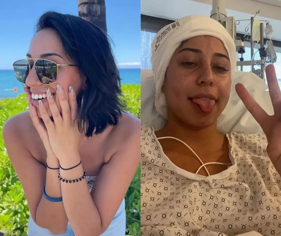 Nhung trieu chung cua benh ung thu thuong bi xem nhe-Hinh-2