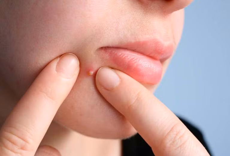 Cach xu ly khi bi nhot