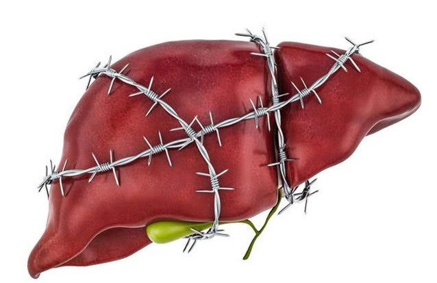 Uống nước theo kiểu này chẳng khác nào "tự đầu độc" ảnh 4 Uống nước theo kiểu này chẳng khác nào "tự đầu độc" ảnh 4