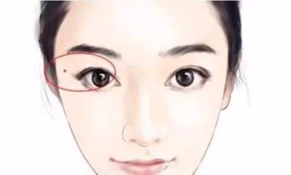 Phu nu neu co 4 not ruoi nay vuong phu ich tu-Hinh-3