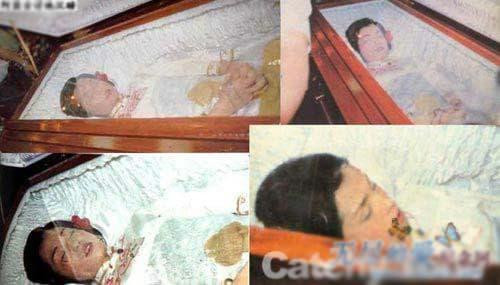 Ong My Linh tu tu, 20 nam sau bac si phap y tiet lo ly do-Hinh-3