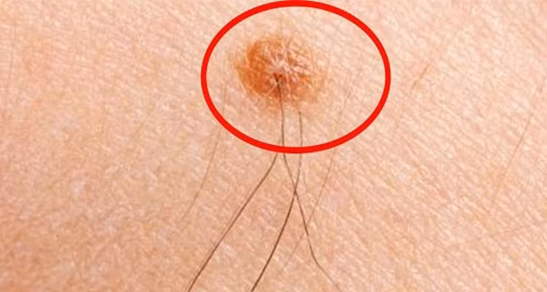 4 vi tri dot nhien moc long gia chu ngoi khong huong loc