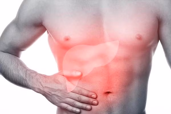 Chuyen gia canh bao bieu hien khi an la dau hieu ung thu gan