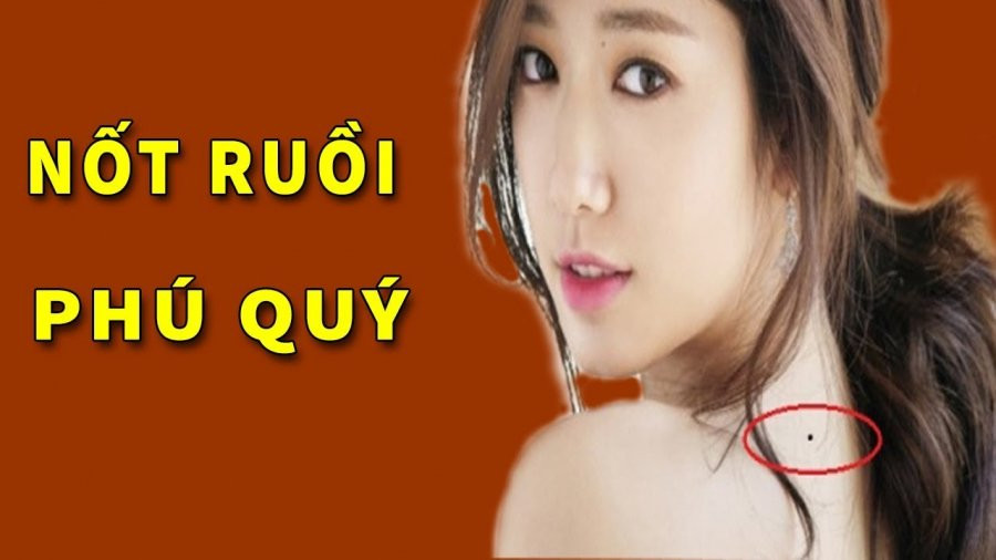 3 nốt ruồi tượng trưng cho Tài - Lộc - Phát, ai được 1/3 cũng hạnh phúc 3 not ruoi tuong trung cho Tai - Loc - Phat, ai duoc 1/3 cung hanh phuc