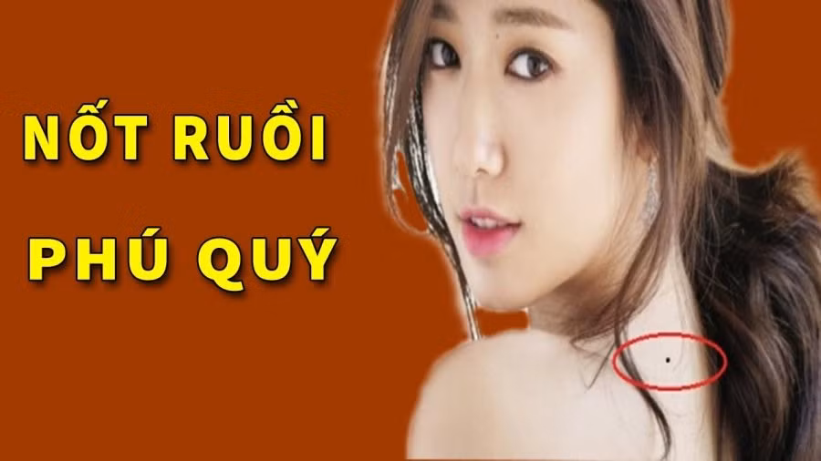 3 nốt ruồi tượng trưng cho Tài - Lộc - Phát, ai được 1/3 cũng hạnh phúc 3 not ruoi tuong trung cho Tai - Loc - Phat, ai duoc 1/3 cung hanh phuc