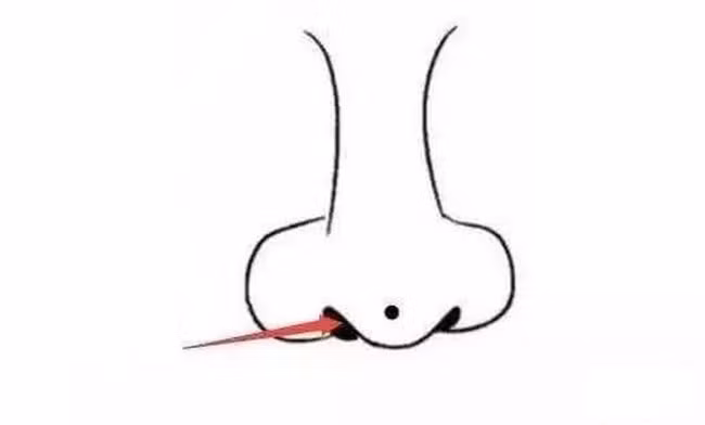 3 not ruoi cuc pham ca doi chang lo tung thieu