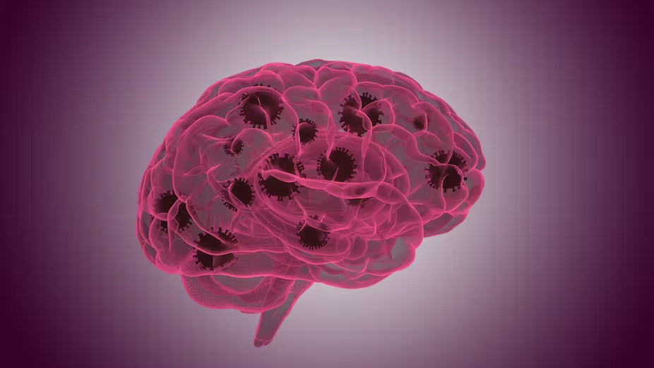 Hien tuong met moi man tinh hau Covid-19, ly do la day!