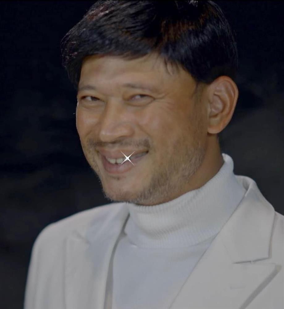 Nhieu nam de dau troc, khi co toc MC Long Vu trong the nao?-Hinh-3