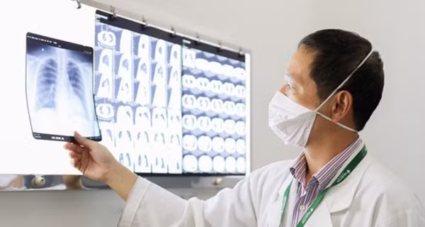 F0 the nhe nhung nguy kich hau COVID-19