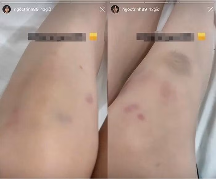 Toc Tien, Phuong Oanh khoe chan bam dap-Hinh-4