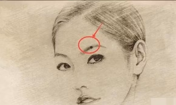 Nguoi co 4 not ruoi nay gap nhieu may man sung tuc