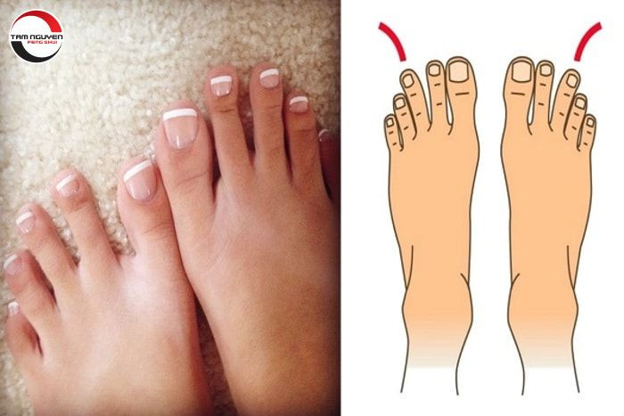 Đồng thời, những người sở hữu tướng bàn chân này thường phúc khí cao hơn người. Bởi vậy, họ thường nhận được nhiều phúc báo cuộc sống nhờ đó mà trở nên dễ dàng, viên mãn, hạnh phúc đủ đầy.