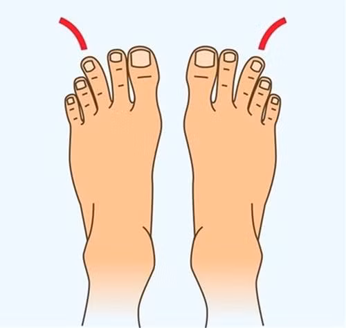 Phần lớn họ đều là người có năng lực vượt trội. Càng lớn tuổi, tài lộc của họ càng dồi dào, khả năng kiếm tiền của họ càng tăng lên. Dựa vào khả năng quản lý tài chính, bạn tích lũy được khối lượng tài sản lớn. Người mang tướng chân này, gặp nhiều may mắn, sau này sẽ trao truyền phúc đức cho con, cháu của mình.