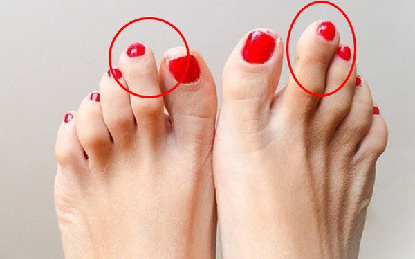 Ngón chân Hy Lạp. Nếu ngón chân thứ hai cao nhất, cao hơn cả ngón cái thì đây là kiểu ngón chân Hy Lạp, mang hình ngọn lửa. Nó cho thấy bạn là người luôn phải cố gắng hòa nhập với môi trường.