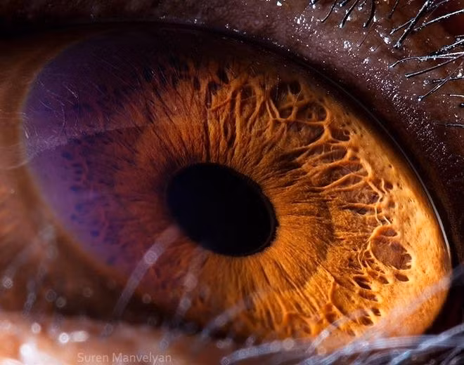 Mắt tinh tinh khá giống với mắt người