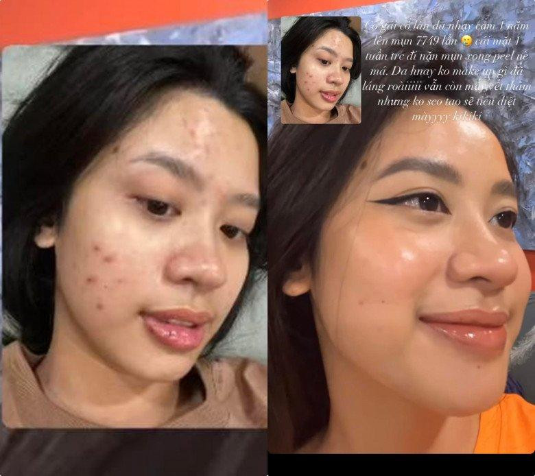 Nga ngua mat moc chi chit mun hot girl noi tieng goc Thanh Hoa