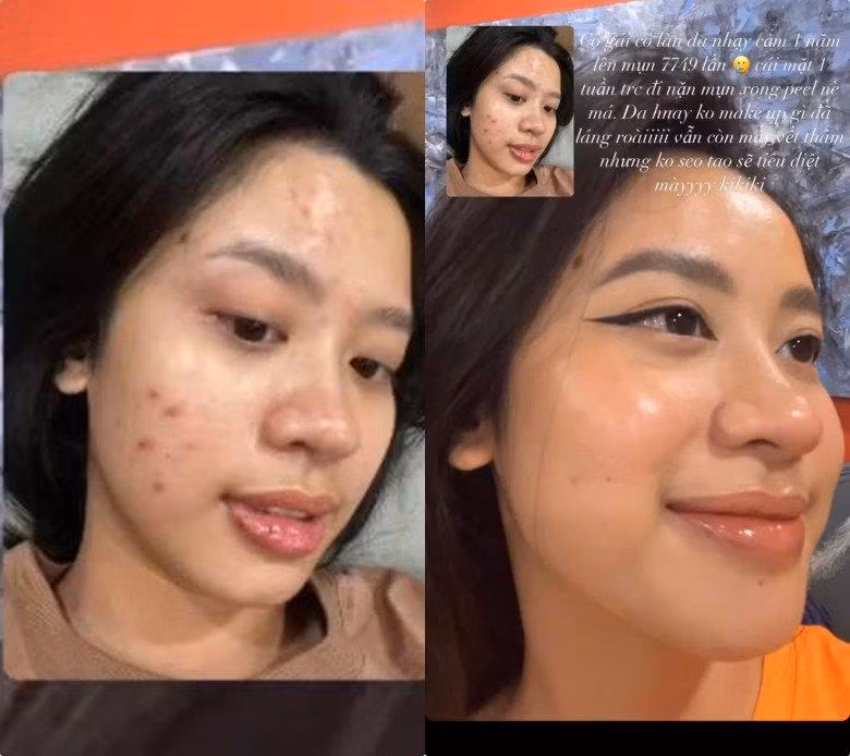 Nga ngua mat moc chi chit mun hot girl noi tieng goc Thanh Hoa