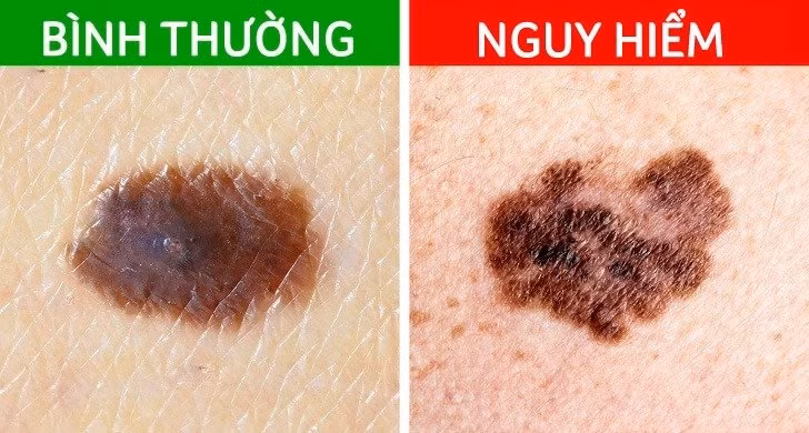 Not ruoi moc o 4 bo phan nay can de y ky-Hinh-3