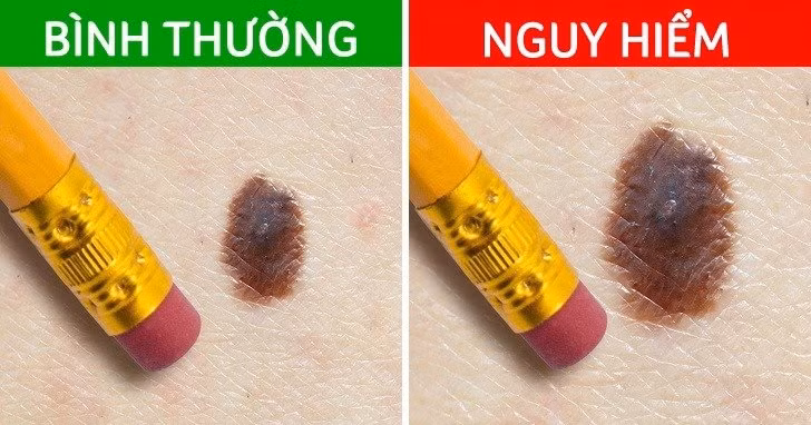 Not ruoi moc o 4 bo phan nay can de y ky-Hinh-5