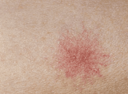 3 mon an sang co the goi la 'vua hai gan'-Hinh-3