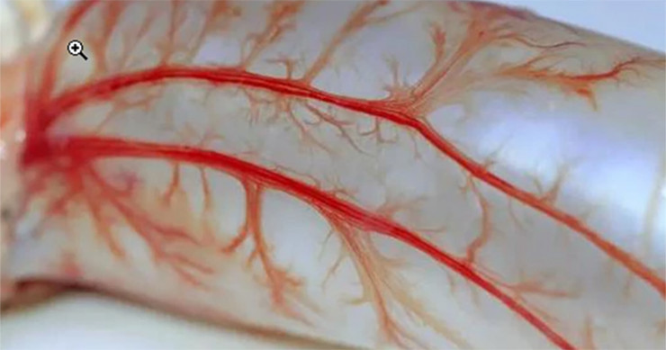 Thu nay trong bung ca nguoi vut di, ngo dau sanh ngang to yen-Hinh-6