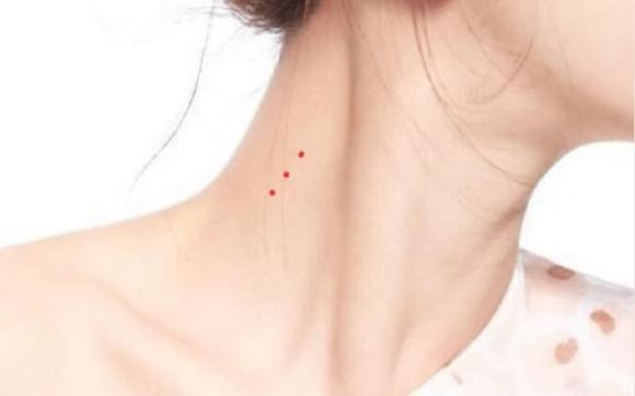 Lòng bàn tay đỏ và nốt ruồi đỏ trên cổ là dấu hiệu của bệnh xơ gan, nhiều bệnh nhân viêm gan B cuối cùng sẽ bị xơ gan, chức năng gan suy giảm sẽ dẫn đến sự tích tụ các hormone trong cơ thể, và các mao mạch ở lòng bàn tay và cổ sẽ nở ra, kéo theo sự phát triển của lông cọ. Trên cổ mọc nốt ruồi nhện đỏ và đỏ.