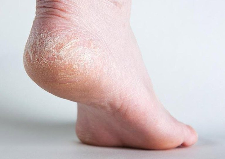 Dùng lược chải 5 vị trí này trên cơ thể: Giúp xua tan bệnh tật - Hình 2 Dung luoc chai 5 vi tri nay tren co the: Giup xua tan benh tat-Hinh-2