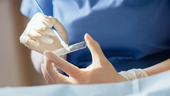 Hanh vi khien nguy co mac ung thu co tu cung tang cao