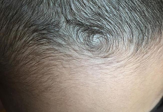 Nhìn xoáy tóc trên đầu đoán tính cách, vận mệnh của con - Hình 4 Nhin xoay toc tren dau doan tinh cach, van menh cua con-Hinh-4