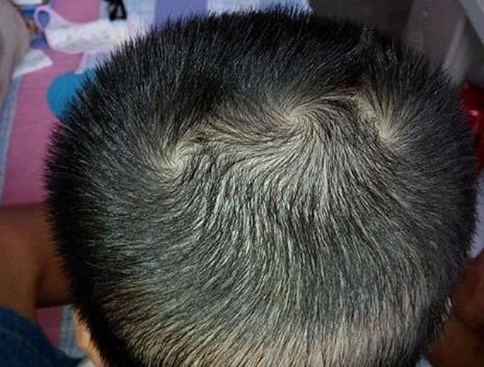 Nhìn xoáy tóc trên đầu đoán tính cách, vận mệnh của con - Hình 3 Nhin xoay toc tren dau doan tinh cach, van menh cua con-Hinh-3