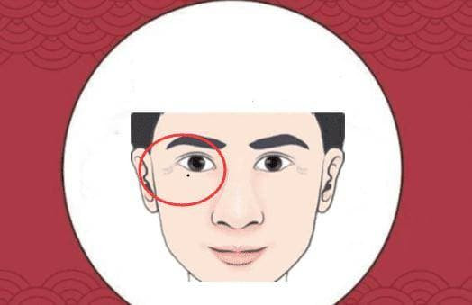 Voi 4 not ruoi “kho o” tren co the, ca doi khong co tien